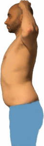 Weight Loss